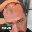 Natural Hair Thickening Fibres