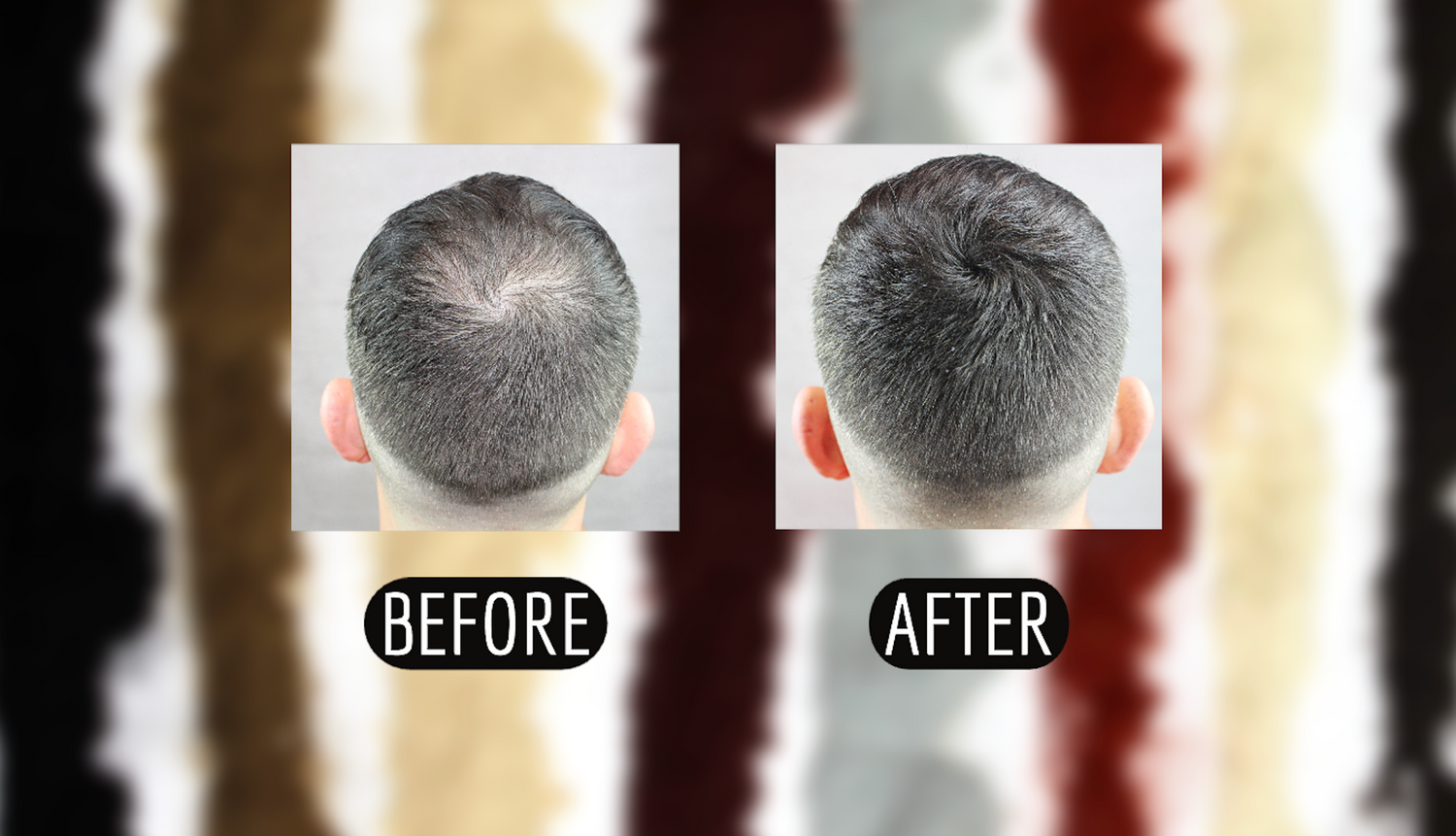 Hair guru london before after pictures fibres hair loss fibers thinning hair loss solutions treatment hair hack