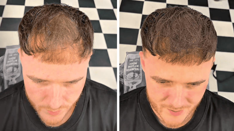 Before and after comparison of our customer wearing hair guru london fibres before and after