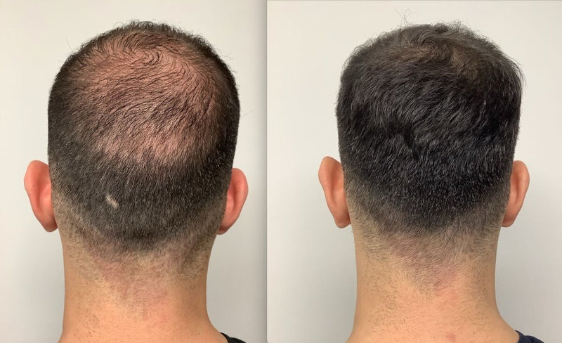 Hair Guru London hair fibres before and after transformation results