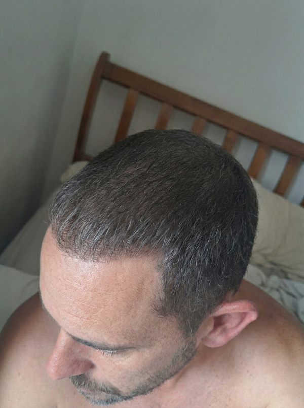 Hair Guru London customer after hair fibres application