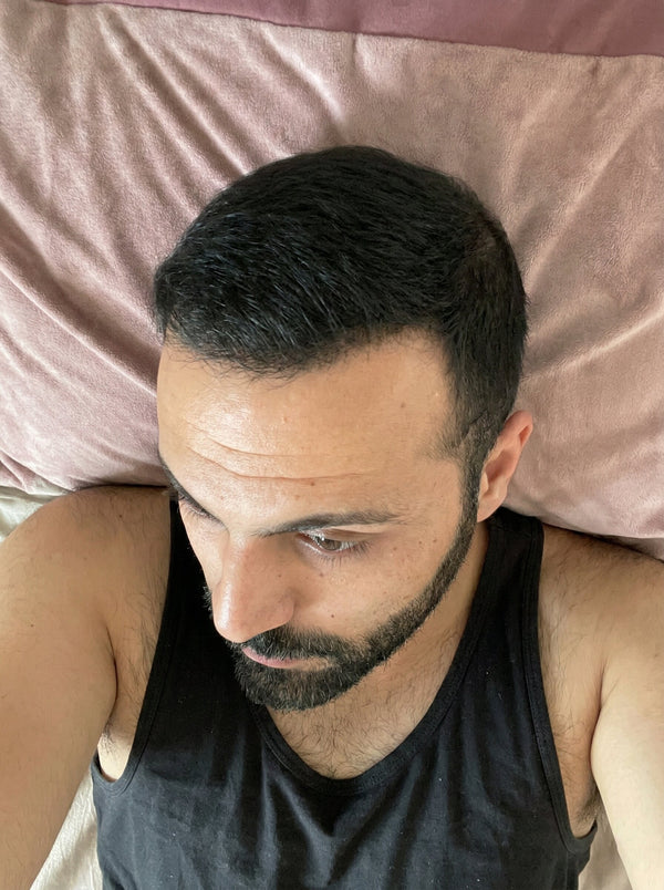 Hair Guru London customer after hair fibres application